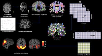 Multi-Modal Imaging in Down's Syndrome: Maximizing Utility Through Innovative Neuroimaging Approaches